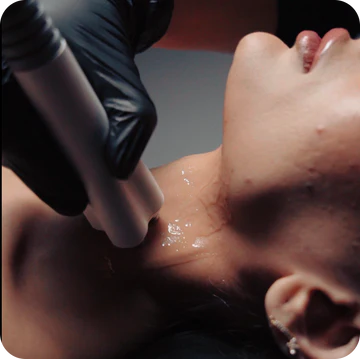 Rectangle_423_1_a0e34aaa-1b0e-41f4-aef2-7bae59d4c130